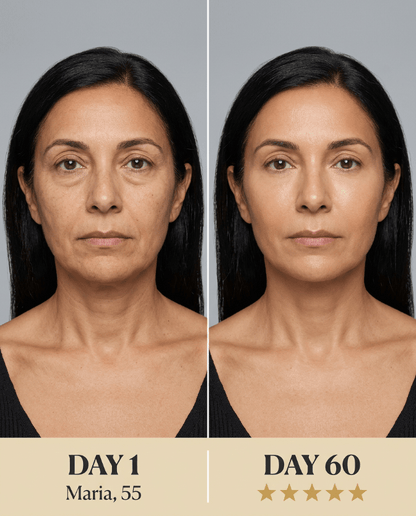 OPULE LED 7 - in - 1 Neck & Face Lift Device - OPULÉ