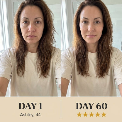 OPULE LED Neck & Face Lift Device - OPULÉ